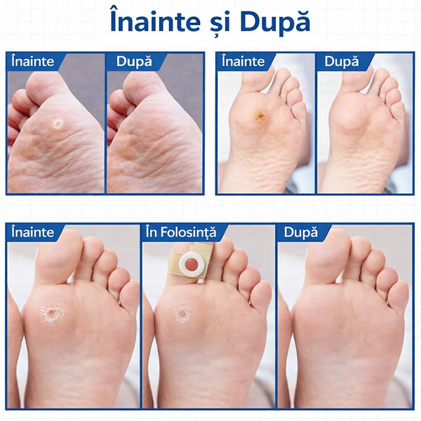 Pansament Reparare Călcâi Rapid